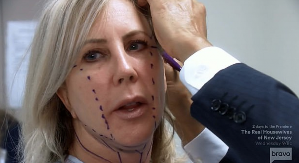 Vicki Gunvalson Goes Under the Knife
