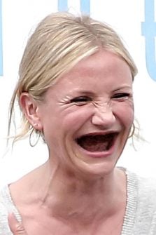 19 Celebrities Without Teeth - The Hollywood Gossip