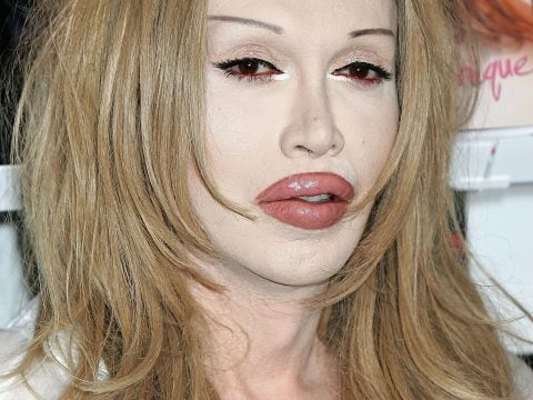Pete Burns