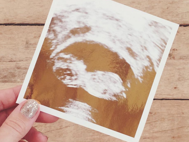 Lauren Conrad Sonogram