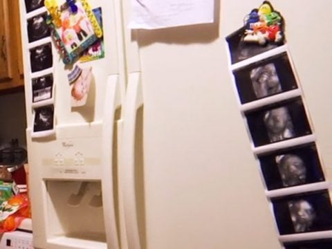 Leah Messer Sonograms