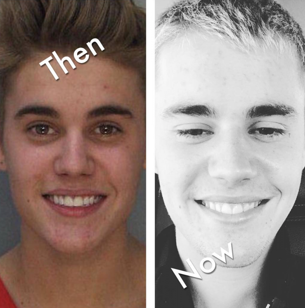 Justin Bieber, Then and Now - The Hollywood Gossip