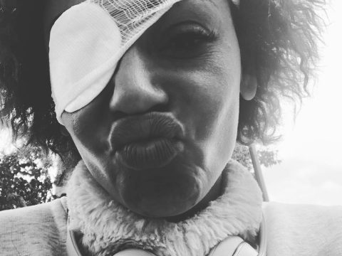 Mel B Wears an Eye Patch