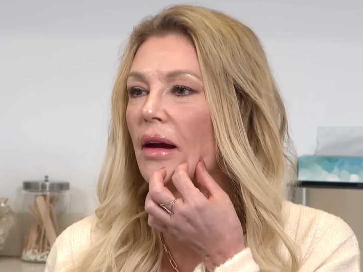 Brandi Glanville: I’m BROKE After Trying to Fix My Face! I’m Still Disfigured!