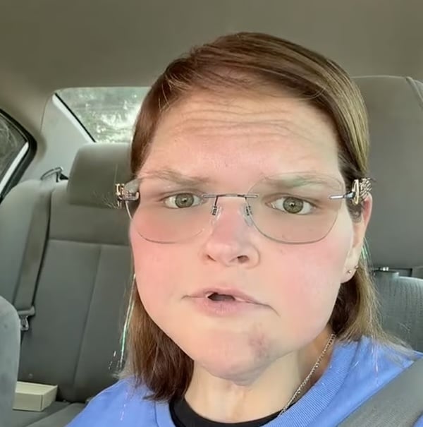 What Occurred to Tammy Slaton’s Face? What Occurred to Tammy Slaton’s Face?