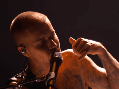 Justin Bieber on the Grammys stage, with a focus on his hairline.