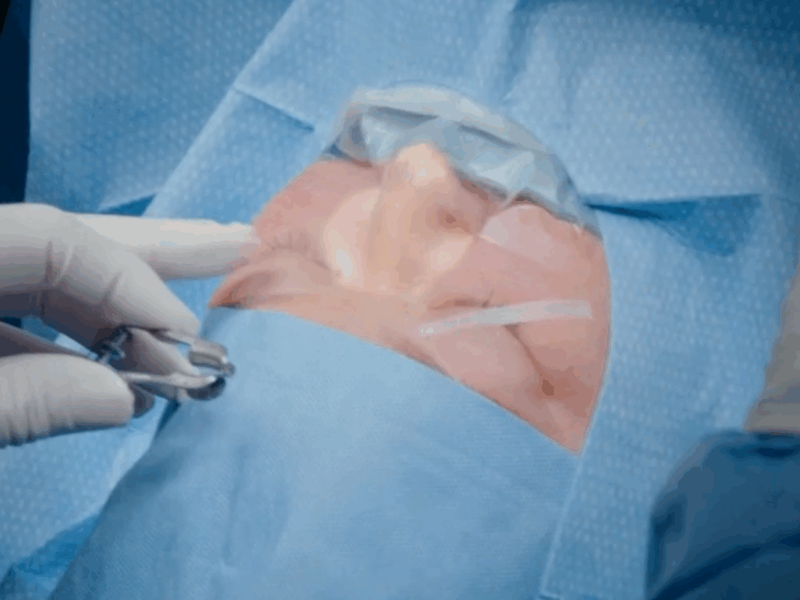 Amy Slaton Undergoes Long-Needed Eye Surgery on ‘1000-lb Sisters’