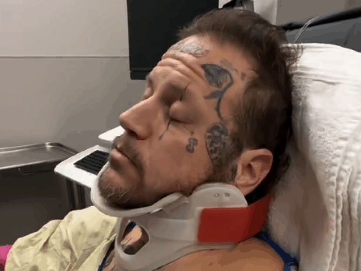 Jelly Roll Reveals ‘Secret’ Hospitalization, Snapped Collarbone