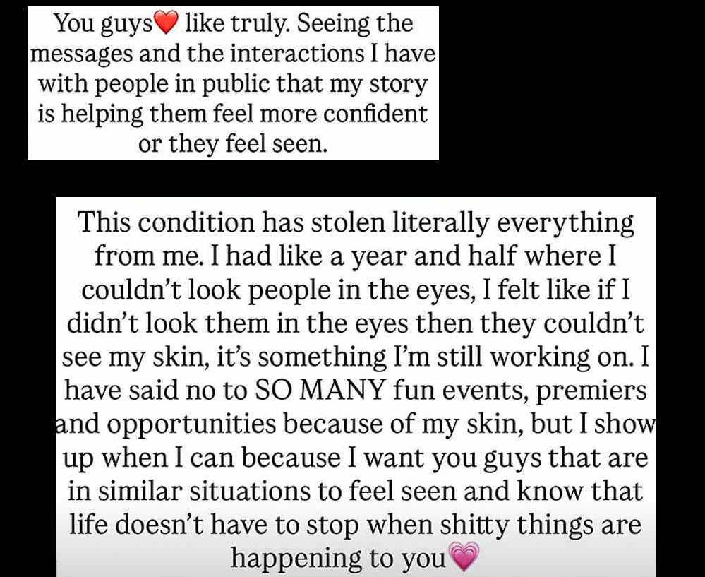 The second Mikayla Instagram Story screenshot of two.