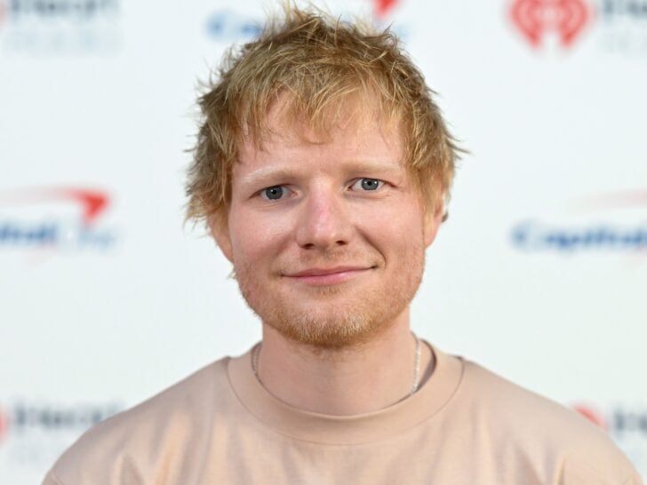 Ed Sheeran Reveals Shaved Head, Herpes Zoster Infection That Ruined His Month