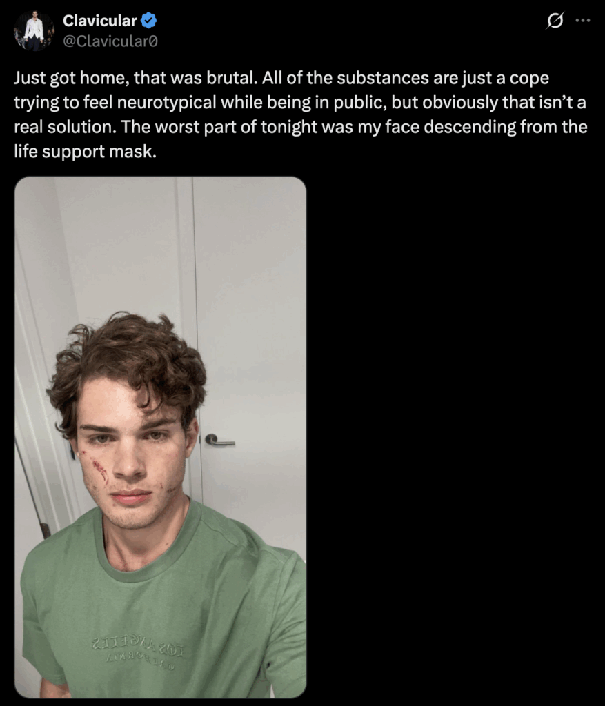 Clavicular updated fans after surviving an overdose.