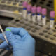 A medical laboratory technician conducts an experiment.